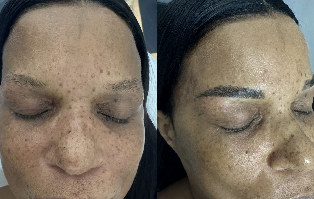 Before and after lamination & tint: the same client before treatment on the left and after on the right