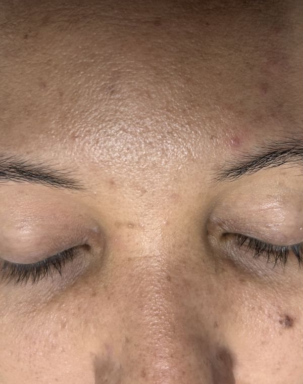 Before microblading: the client before treatment