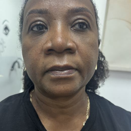 Brow work by Ellimak Aesthetics